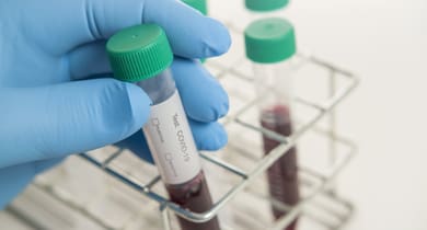 Close-Up Tests COVID-19