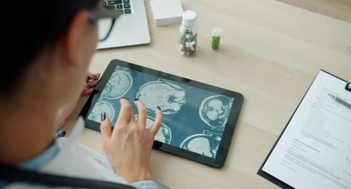 Person betrachtet Gehirnscans auf einem Tablet.