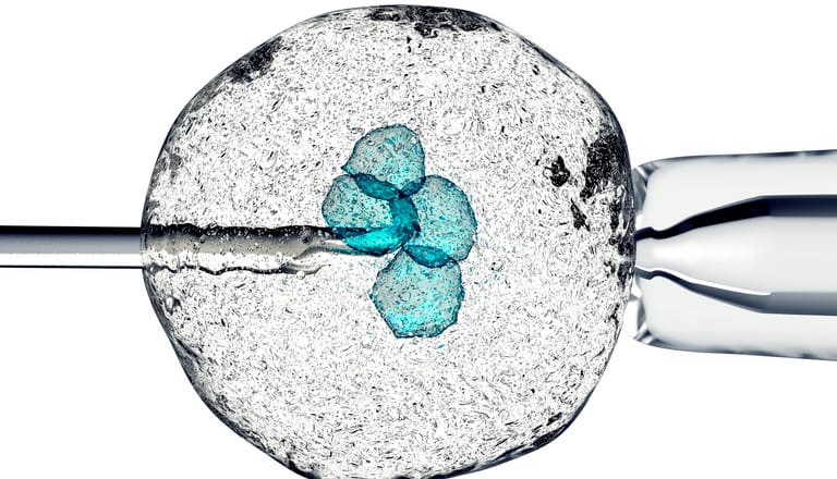 In-Vitro Fertilisation