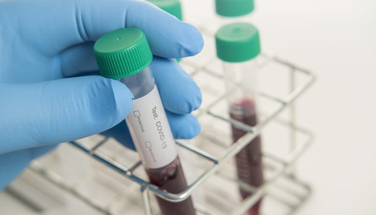 Close-Up Tests COVID-19