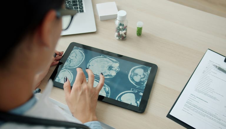 Person betrachtet Gehirnscans auf einem Tablet.